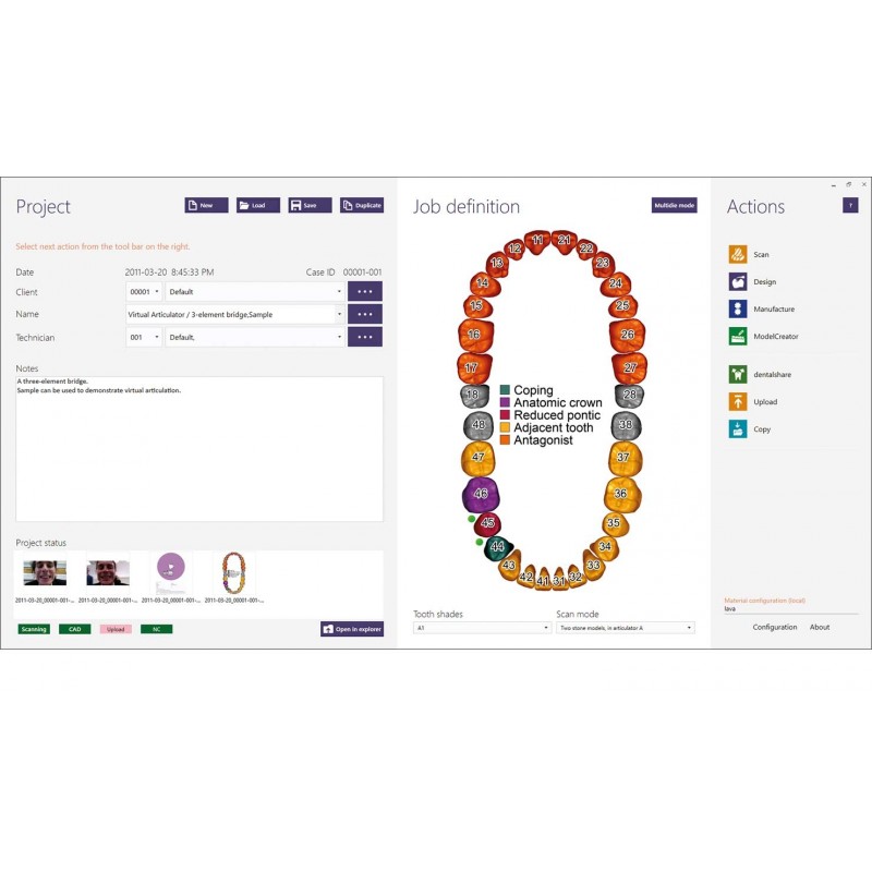 Program CAD/CAM exocad Standard exocad