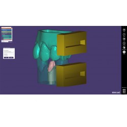 MODUL EXOCAD Model C