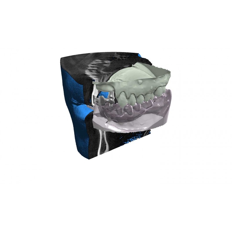 Modul exocad exoplan viewer