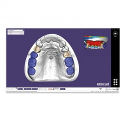 Modul exocad proteza scheletata