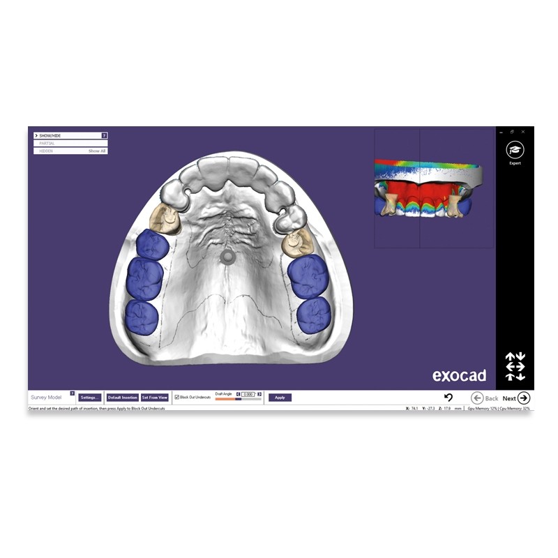 Modul exocad proteza scheletata