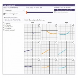 MODUL EXOCAD Jaw Motion Import