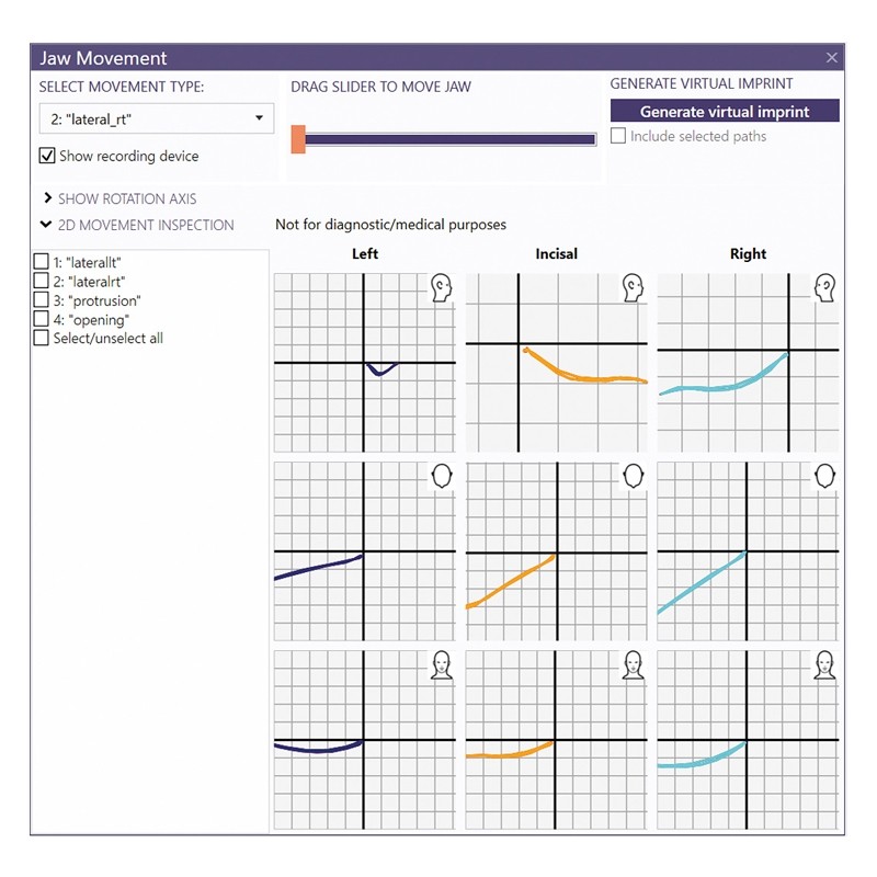 MODUL EXOCAD Jaw Motion Import