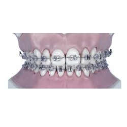 Arc Ni-ti rectangular sup.0.16x0.22 -10buc