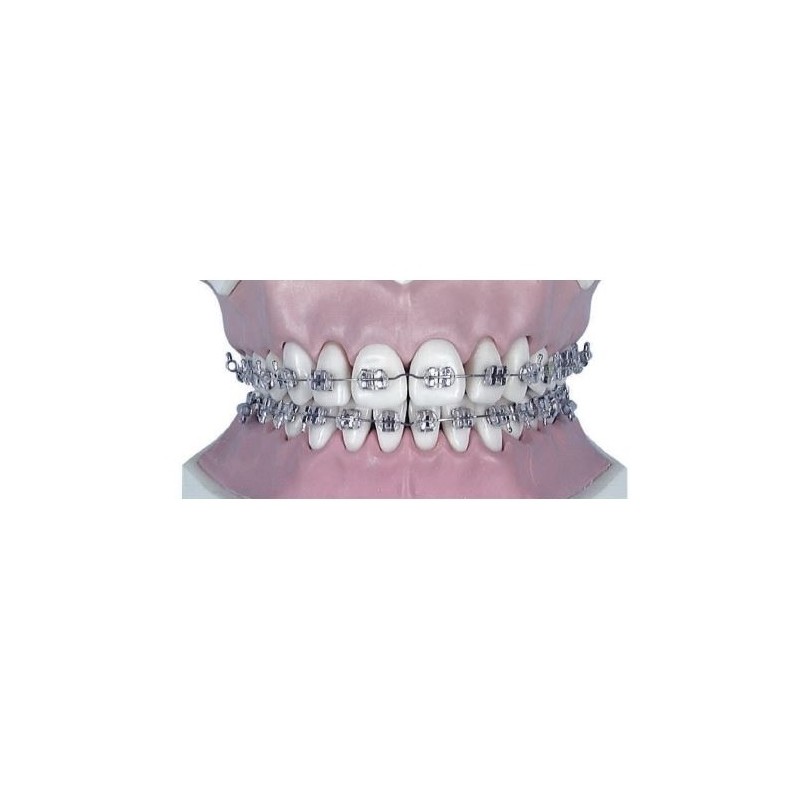 Arc Ni-ti rectangular inf.0.16x0.22-10buc