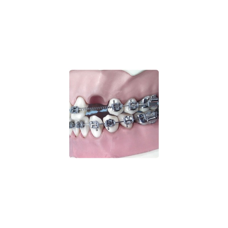 Arc deschis Coil Spring pt extraoral .045/010 lip bumper 2 buc.