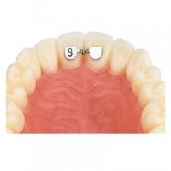 Retainer Superior incisivi centrali 6mm Leone