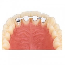 D.B. RETAINERS - UPPER LAT/LAT 18mm - 10buc