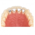 D.B. RETAINERS - UPPER LAT/LAT 18mm - 10buc