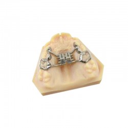 CAD/CAM gyors expander diszjunkciós csavar 13mm Leone