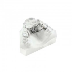 Palatinális diszjunkciós csavar Memoria Leaf rugókkal 6mm 2 rugó 900g LEONE