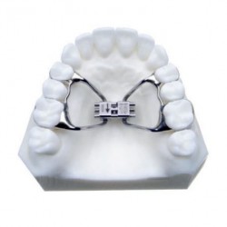 Rapid Expander ortogonális karokkal rendelkező diszjunkciós csavar 8mm 1 db Leone