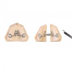 Teleszkópos szétválasztó csavar CAD – CAM Expander 10mm LEONE