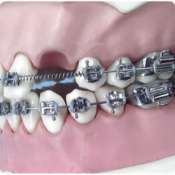 Arc Memoria Resort Deschis