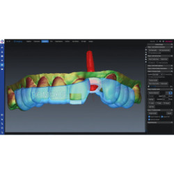 Romexis 3D Implant Guide