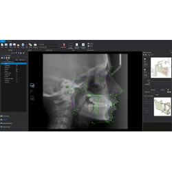 Romexis Cephalometric Ananlysis