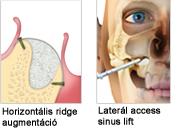 osteobiol_indikaciok_mp3.jpg