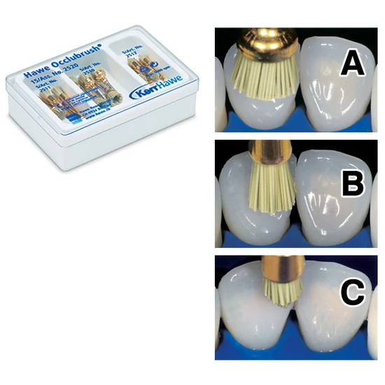 Occlubrush Assorted Kit 5x reg.kehely/5x kis kehely/5x csúcs