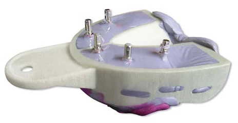 Miratray Implant  felső OK S1 small  6db